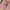 Eye Patch Silicone - Patch oculaire en silicone (réutilisable) — vue 2 | SHOPDERMOPRO